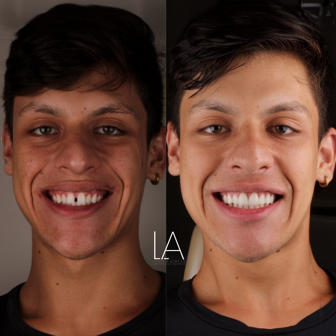 Antes e depois — caso 1