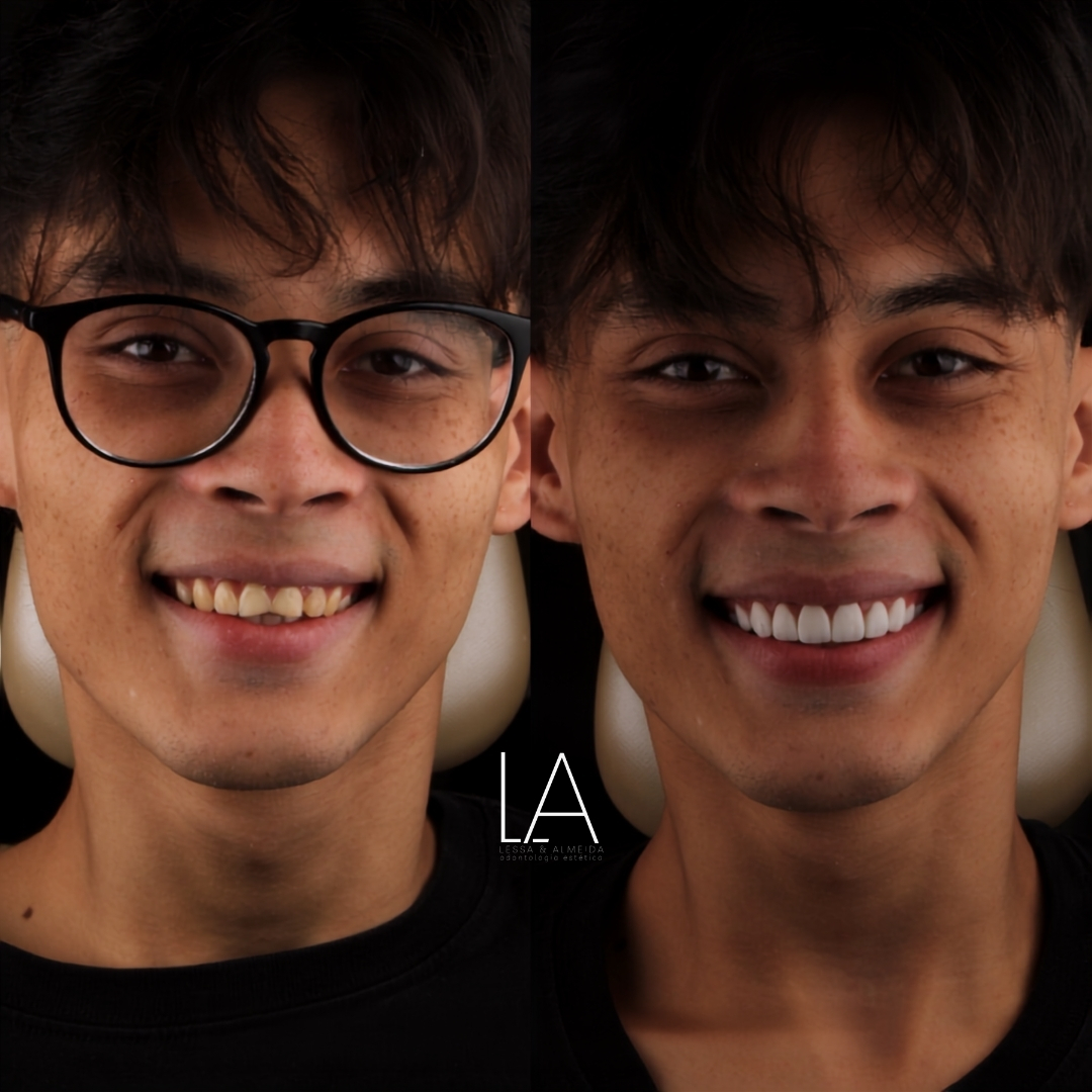 Antes e depois — caso 3